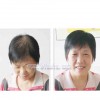找信譽好的織發(fā)補發(fā)就到創(chuàng)藝補發(fā)_蘭州補發(fā)中心